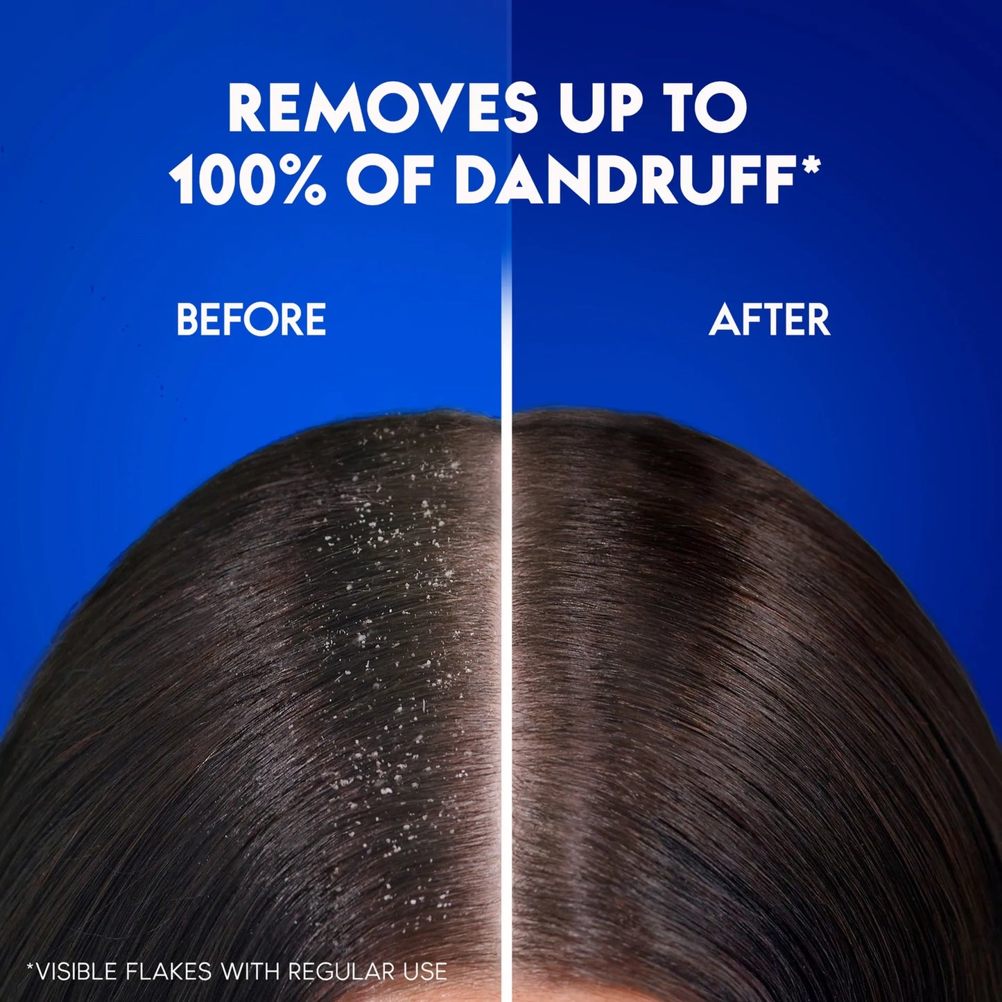 Head & Shoulders Dry Scalp Care Anti-Dandruff Shampoo 400ml