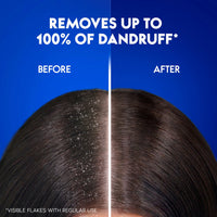 Head & Shoulders Dry Scalp Care Anti-Dandruff Shampoo 400ml